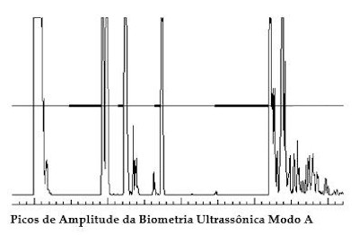 Biometria ultrassônica.